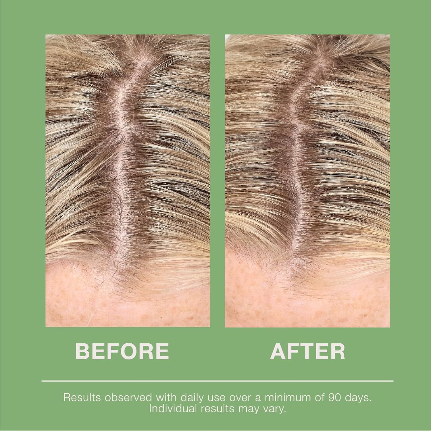 mumms Scalp Serum, Hair Growth Treatment with Saw Palmetto and Ginger Root, 2 fl oz, Daily Use