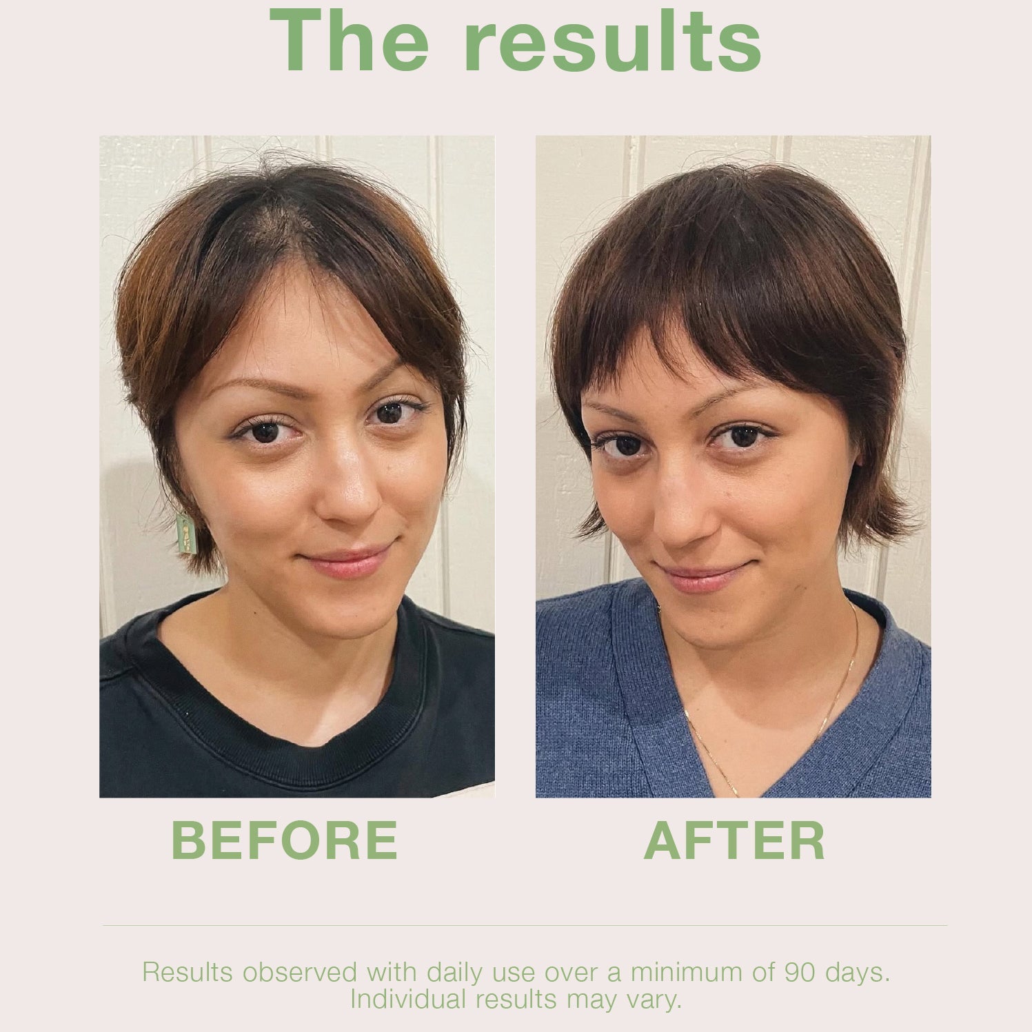 mumms Scalp Serum Hair Growth Treatment with Saw Palmetto and Ginger Root 2 fl oz Daily Use